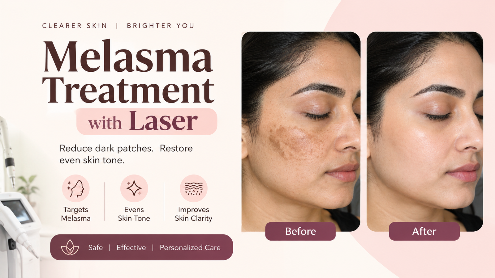 Pigmentation Treatment: Causes, Options & When to See a Skin Specialist