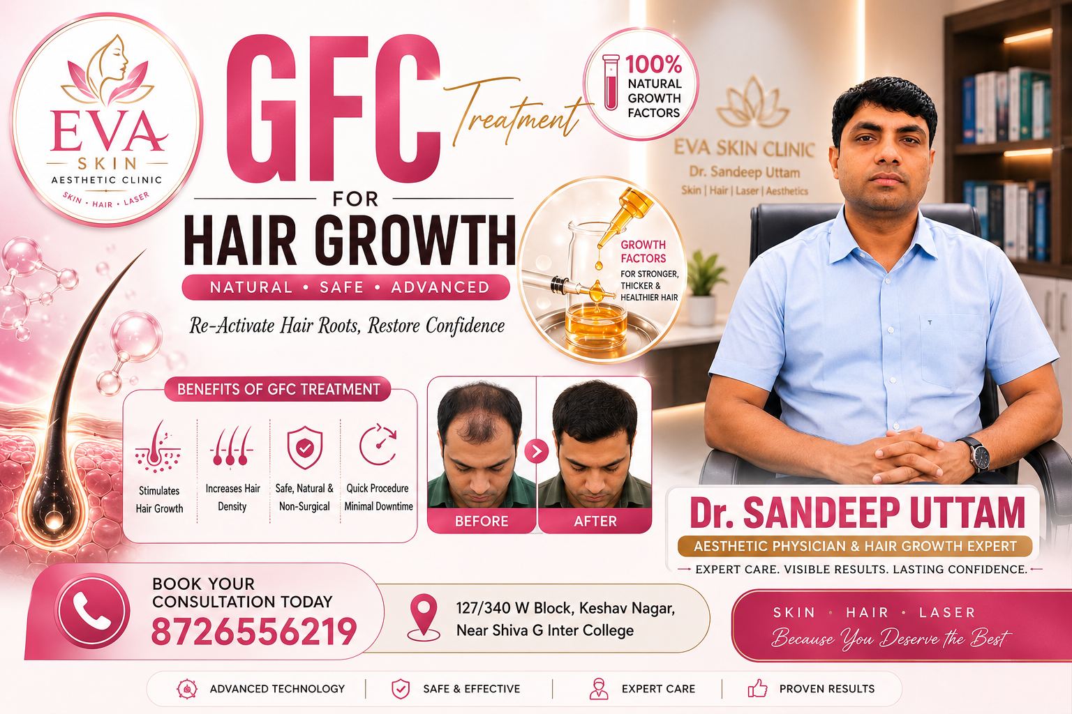 GFC Treatment for Hair Regrowth: What You Need to Know
